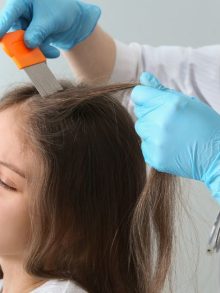 Understanding the Life Cycle of Lice: A Guide for Prevention and Control
